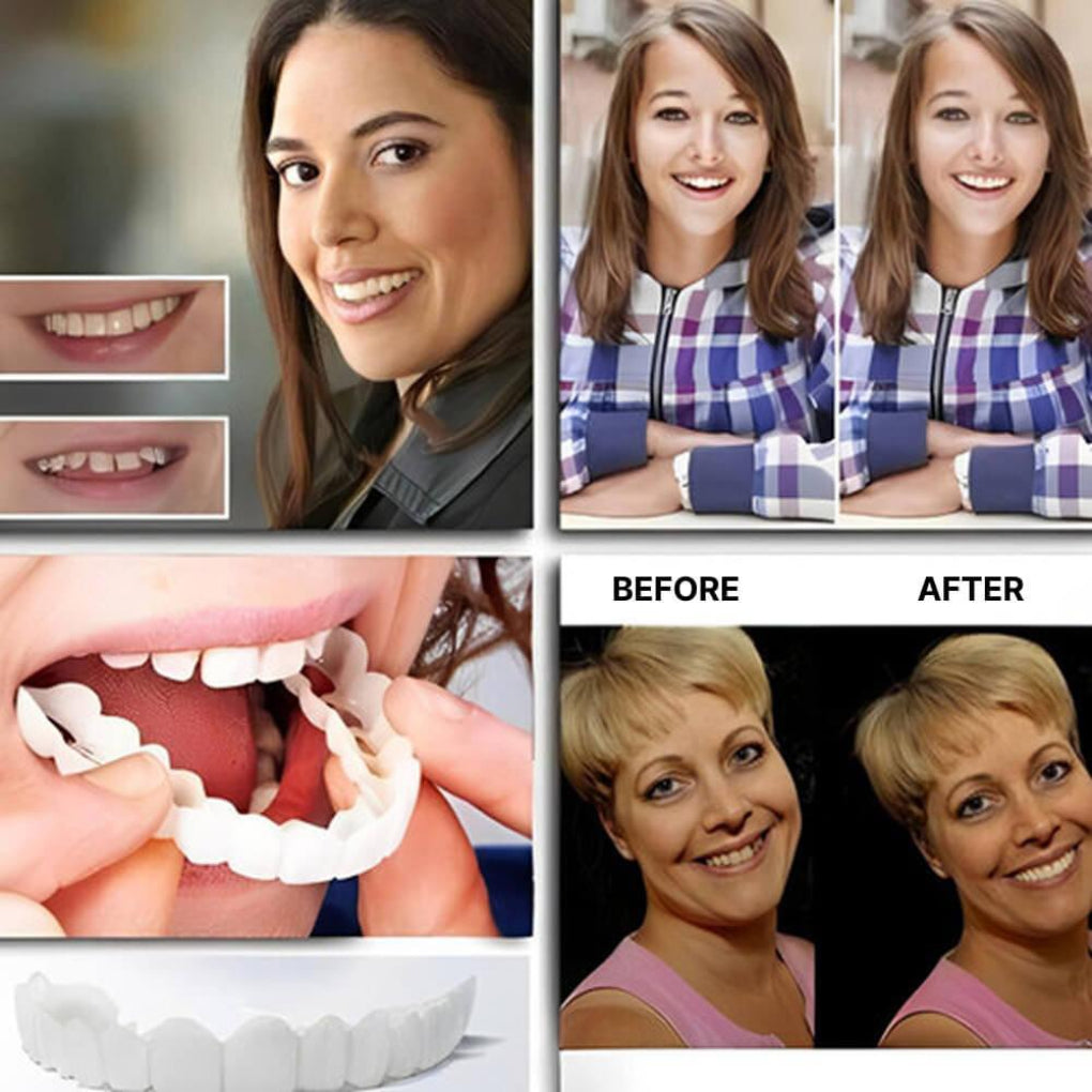 Clip-On Dental Veneers zaxx